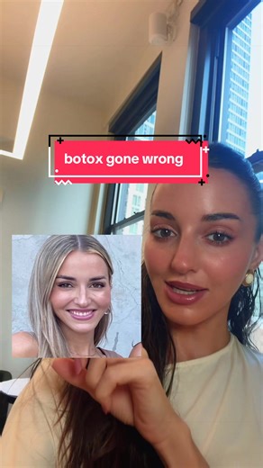 Botox Gone Wrong: The Dangers of Chasing Wrinkles