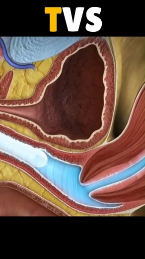 3D Animation Of Transvaginal ultrasound TVS #doctor #documentaryphotography #DoctorWho # reel # shorts #DoctorWh#doctor | SMART Doctor