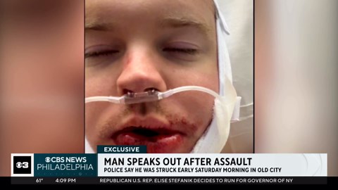 Suspect wanted after random attack leaves victim badly injured: "It was a totally vicious attack."