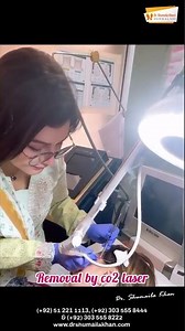 Intradermal Melanocytic Nevus mole Removal by CO2 Laser | Dr Shumaila Khan
