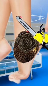 How to remove and treat severe dog ticks infestation on legs part 1 | Sakir 1