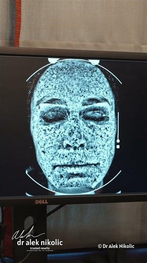 ✨ Skin clarity starts with understanding.