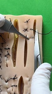 145K views · 875 reactions | Horizontal mattress stitch | Dermhacks | Facebook