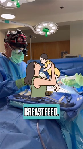 Clareo Plastic Surgery on Instagram: "✨ Breastfeeding After Breast Augmentation — Patient Experience ✨ An important and often misunderstood topic: breastfeeding after breast augmentation. This patient was able to successfully breastfeed both of her children, and her experience highlights an important medical fact — having breast implants does not automatically prevent breastfeeding. 🩺 Educational facts about breastfeeding with implants: • Most breast augmentations do not interfere with milk pro