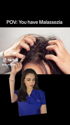 Understanding and Treating Malassezia Folliculitis: Effective Solutions