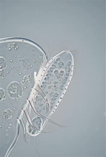 Amoeba Engulfing Paramecium | Real Microscopic Hunt