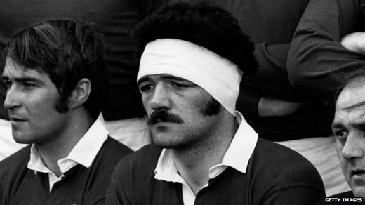 Wales rugby legend Mervyn "Merv the Swerve" Davies dies