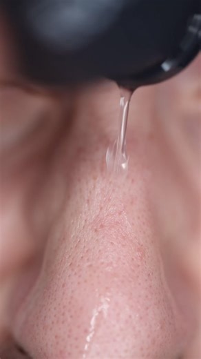 The BEST liquid exfoliant for the nose?
