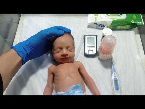 Adorable Premature Baby Care | Feeding Trial, Temperature Check & Complete Neonatal Care