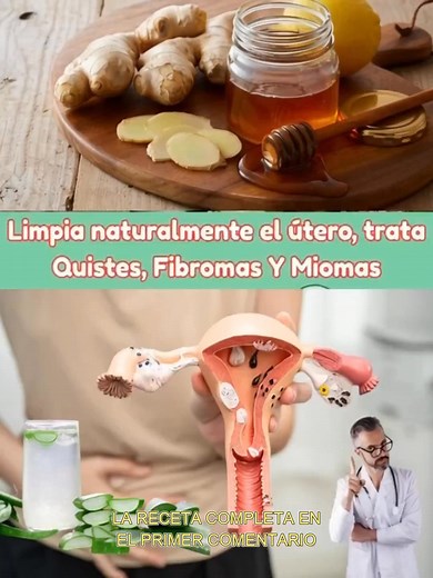 Cómo cuidar y limpiar el útero naturalmente ante quistes, fibromas y miomas... 👇❤️Para seguir recibiendo mis recetas, solo debes decir algo… | Recetas De Mi Tia