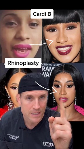 Cardi B Plastic Surgery Secrets Revealed