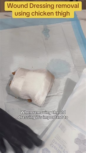 Wound care isn’t just about what you apply — it’s how you remove it 🩹 This simulation shows proper removal of an old wound dressing to protect tissue, minimize trauma, and promote healing. Technique matters — even during removal. Old dressings should be removed slowly to avoid tissue damage. Always support the skin, assess the wound, and document findings. Save this for skills check-offs, clinicals, or refreshers 👩🏽‍⚕️👨🏽‍⚕️ #fypviraltiktok🖤シ゚☆♡ #nursingstudent #woundcare #wounddressing #nu