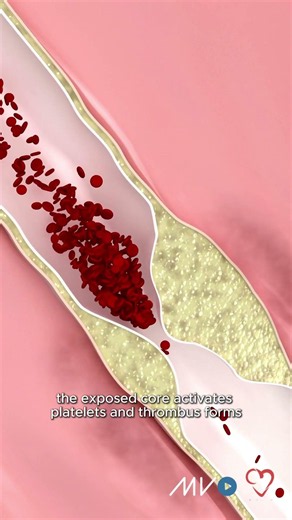 Hypertension is one of the most common and most modifiable drivers of ....