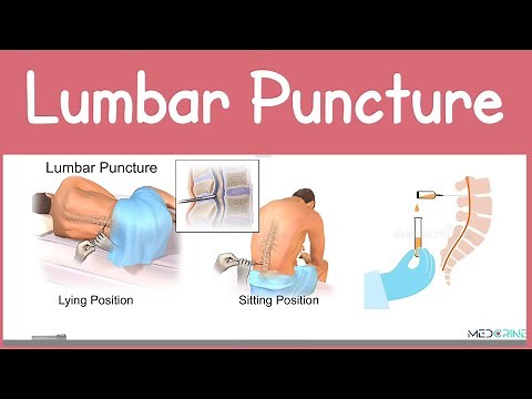 Lumbar Puncture (Spinal Tap) Explained | Anatomy, Procedure, Indications and Contraindications