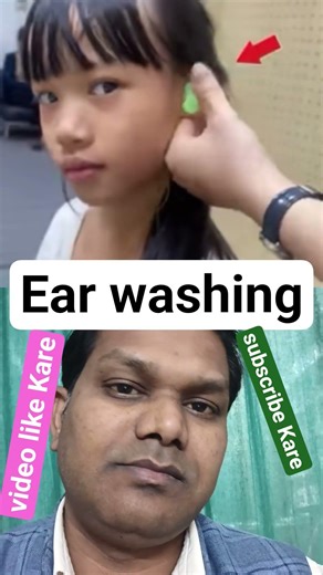 Viral ! Girl hearing aid mold making # shorts #ashortaday #trending #facts #shortsfeed #vlog