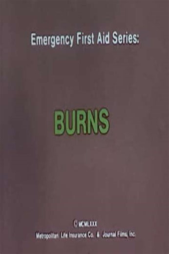 Emergency First Aid Series: Burns (1980) - Movie