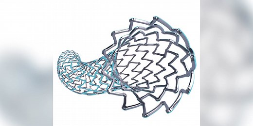 Medical Moment: SYNERGY MEGATRON stent saving lives
