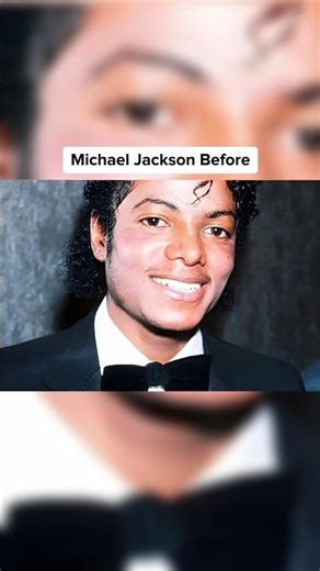 Extreme Plastic Surgery Fails 😳 #shorts