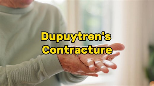 Are your fingers curving dupuytren's contracture? | Doctors explain