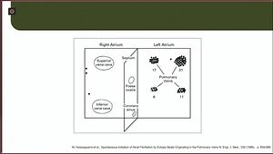 Atrial Fibrillation Management: Integrating Guideline Changes Into Clinical Practice