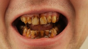 Guy Eating Chocolate On His Teeth Stock Footage Video (100% Royalty-free) 1069968472 | Shutterstock