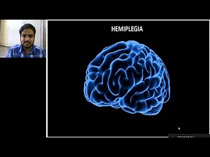 NEUROLOGY PRACTICAL ORIENTED THEORY DISCUSSION FOR MBBS STUDENTS ( UMN VS LMN) --VIDEO 1