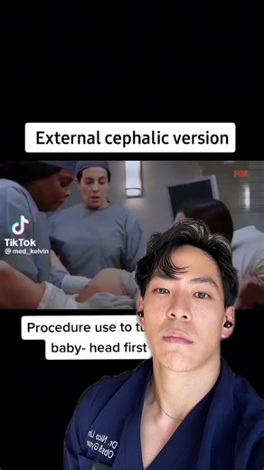 Understanding External Cephalic Version for Breech Births