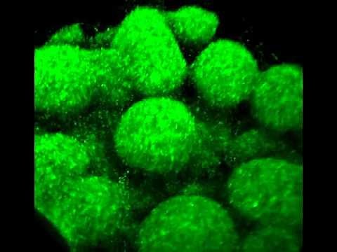 CSLM 3D view of Pseudomonas aeruginosa biofilm structure