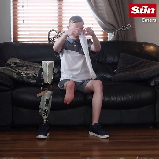"I have a backwards foot" | The Sun