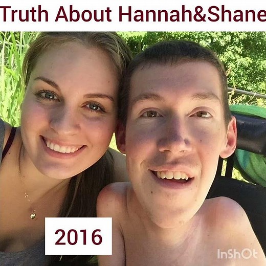 Squirmy and Grubs .Truth of Hannah Burcaw .# Love Life #awarness