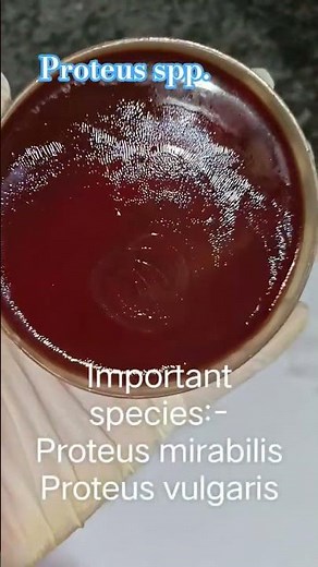 Proteus species ( Swarming on blood agar) # #bacteria