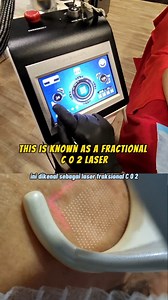 This is still one of my favorite treatments for deep acne scars and overall skin rejuvenation. @mediiskinstudio @mediiskinstudio @mediiskinstudio | Dr Lim Ing Kien