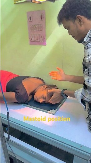 Mastoid position oblique #radiology #medical #explore #hospital #radiology #reels #reels #education