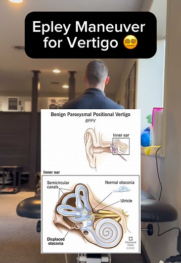 BPPV Vertigo Relief: The Epley Maneuver Explained