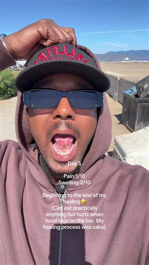 My Tongue Piercing Healing Journey: 5-Day Pain & Swelling