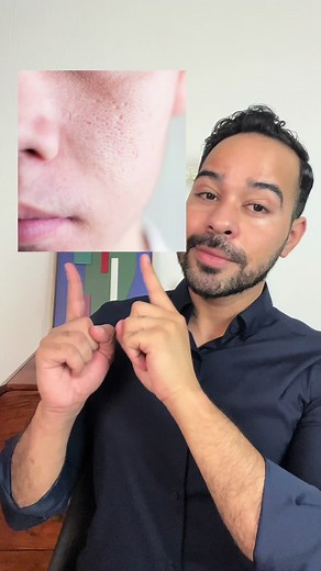 Sérum Cleanance d’Avène pour une Peau Neuve