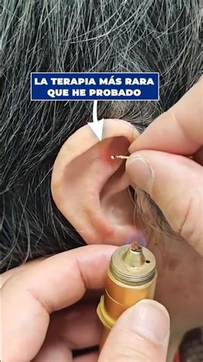 The strange therapy of the lit thread