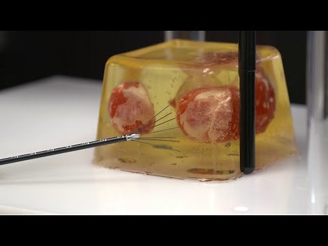 Treating Fibroids with Heat