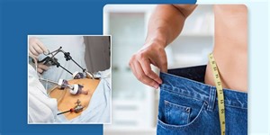 Bariatric Surgery: Types, Benefits & Precautions