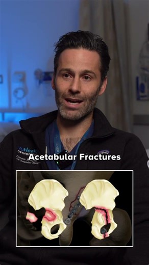 HIP INJURIES EXPLAINED by Trauma Surgeon 🦵💥 Fractures, dislocations, complex trauma — Dr