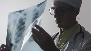 Doctor Studying X-ray Medical Worker Makes: vídeo stock (100% livre de direitos) 27804331 | Shutterstock