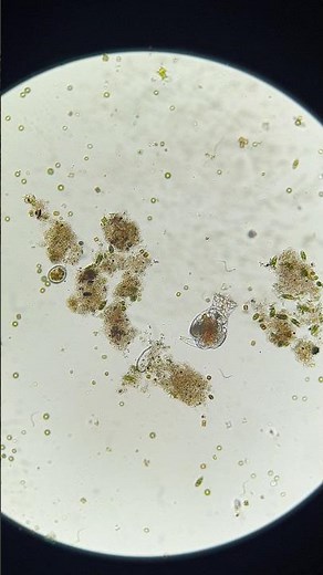 Rotifers foraging #rotifer #rotifera #microscope #undermicroscope
