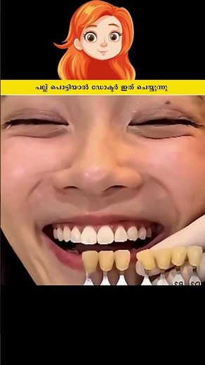 പല്ല് പൊട്ടിയാൽ ഡോക്ടർ ഇത് ചെയ്യുന്നു #shorts