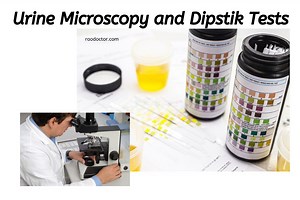 What Your Urine Microscopy And Dipstick Results Mean