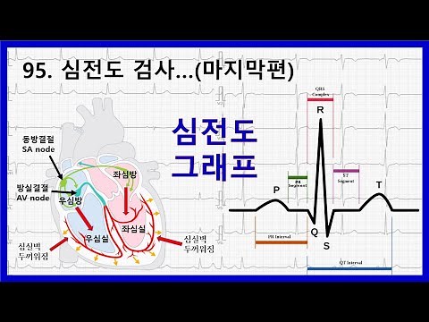 95. 심전도 검사에 대하여 - 심전도 그래프 설명