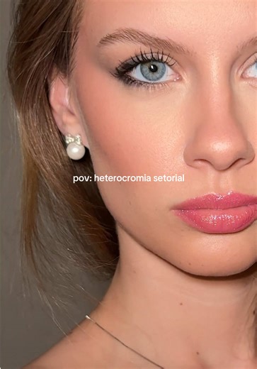 #heterocromia #heterochromia