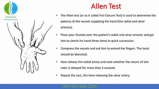 Allen Test Steps