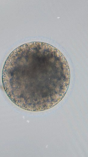 Investing in my goals and investing in my mare. Four frozen embryos in the tank! Adios Pantalones x Bragg on Leader Made possible by Equine IVF and Ray with Crystal Spring Stable! Blown away from the result of our first aspiration and ICSI cycle. #movingforward #goalsinreach #trueinvestment | Lenora Bryer