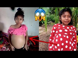 😱¡¡IMPACTANTE.. Niña de 8 años Resultó de esta manera.. ella no sabe lo que está pasando 🥺🥺