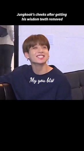 Jungkook's cheeks after getting his wisdom teeth removed #jk
